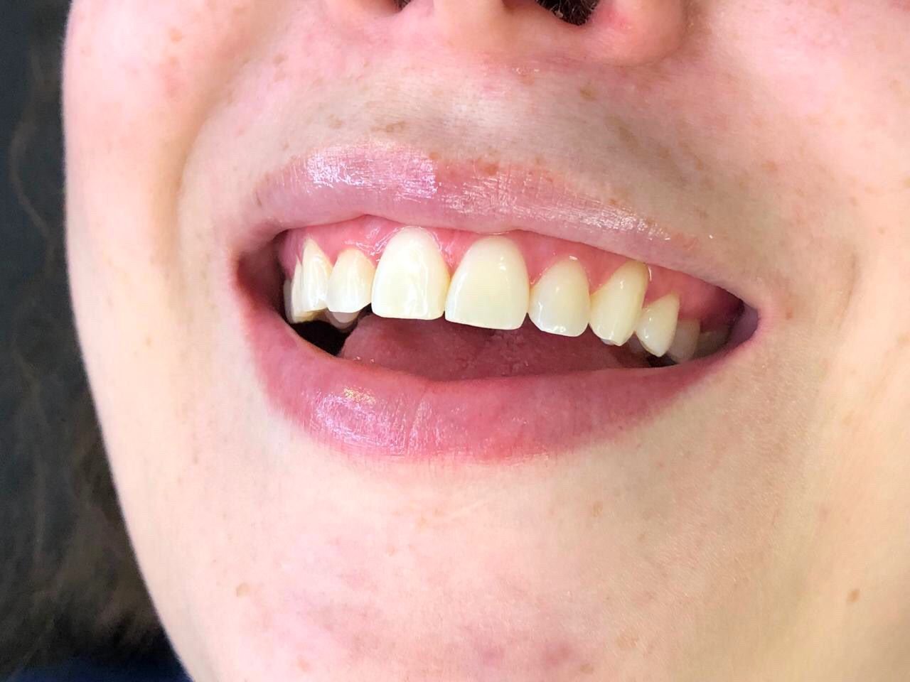 Odontologia Estética - Pródente Life