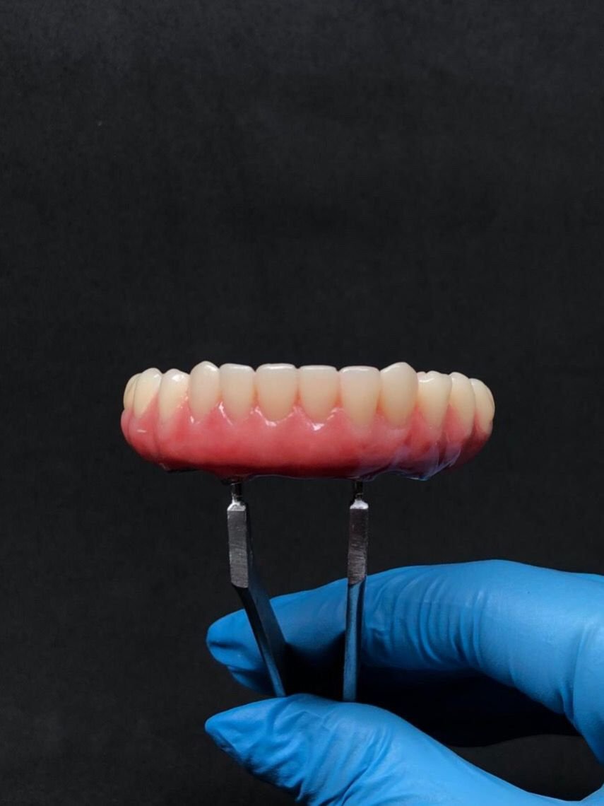 Prótese Dentária - Pródente Life